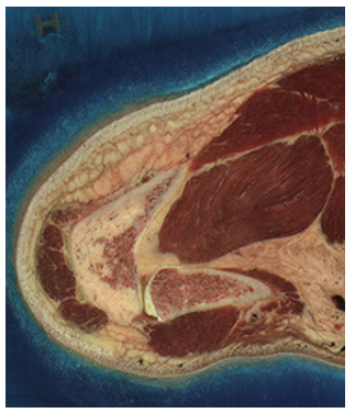 A transverse section of a human left shoulder.