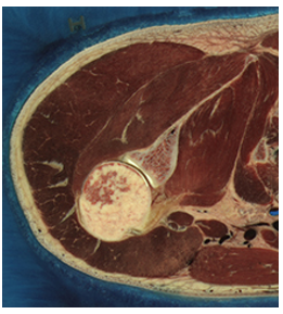A transverse section of a human right shoulder.
