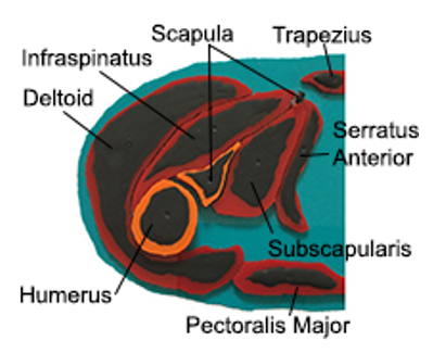 A stratographic diagram of the transverse section of a human right shoulder, with parts labeled, deltoid, infraspinatus, scapula, trapezius, serratus anterior, humerus, subscapularis, pectoralis major.