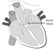 A diagram of the heart with an arrow labeling the aortic valve.